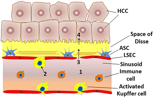 Figure 3 An outline of the major challenges that are encountered in gene delivery to HCC. (1) The systemically administered vectors must escape from the host immunity and from the reticulo-endothelial system and possess a sufficient residence time in blood circulation in order to reach the tumor region. (2) The administered vectors must escape the phagocytosis promoted by the activated Kupffer cells in the tumor microenvironment. (3) The vectors must be small enough to extravasate from the narrowed fenestrations and to penetrate the stroma-rich tumor microenvironment to access HCC cells. (4) The vectors must be taken up efficiently and selectively by HCC cells, with a subsequent escape of the nucleic acid cargos from lysosomal degradation to exert their intracellular action. The figure is reprinted from Younis MA, Khalil IA, Harashima H. Gene Therapy for Hepatocellular Carcinoma: highlighting the Journey from Theory to Clinical Applications. Advanced Tharapeutics. 2020;3(11):2000087. © 2020 Wiley-VCH GmbH..Citation9