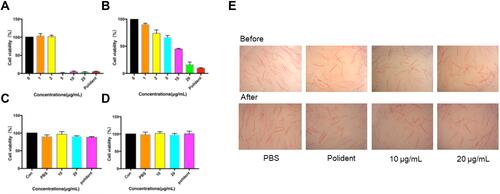 Figure 8 Cytotoxicity of AgBr-NP@CTMAB and color change of PMMA specimens. (A and B) Different concentrations of AgBr-NP@CTMAB were added directly to the culture medium and the cell viability of HOECs (A, P<0.001 for 5 μg/mL, 10 μg/mL, 20 μg/mL AgBr-NP@CTMAB, and Polident when compared with control) and HGFs (B, P<0.01 for 2 μg/mL, 5 μg/mL, 10 μg/mL, 20 μg/mL of AgBr-NP@CTMAB, and Polident when compared with control) was measured by CCK-8 assay. (C and D) The residual cytotoxicity of AgBr-NP@CTMAB after washing 3 times with PBS on HOECs (C, P>0.05 among all groups by one way ANOVA) and HGFs (D, P>0.05 among all groups by one way ANOVA) was measured by CCK-8 assay. (E) Color change of PMMA specimens after a repeated immersion cycles in AgBr-NP@CTMAB solutions for 7 days.