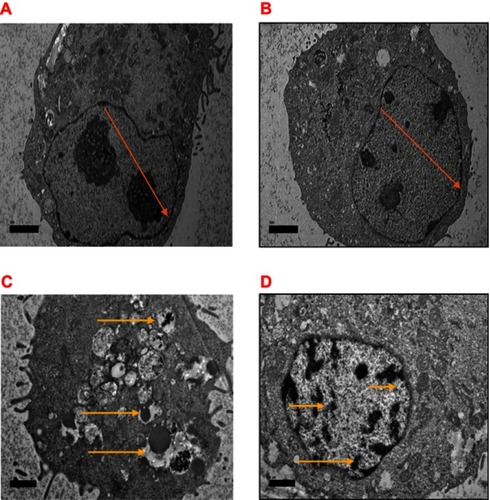 Figure 12 Electron micrographs of MCF-7 cells (A), control untreated cells and (B) treated with NPs exhibiting normal cellular method containing unabridged integrity of cells organelle, with rounded shaped cells containing nucleus and nucleolus chromatin (orange arrow) (C) Treated with DOX with switch nuclear collapse, progressing blebbing, apoptotic body formation (yellow arrow), and (D) treated with NP-DOX revealing chromatin condensation, bar 2 µm.