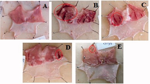 Figure 3. Effect of GCE on the macroscopic appearance of the stomach mucosa in ethanol-induced stomach mucosa injuries in rats. (A) Normal control group exhibited no injuries to the gastric mucosa. (B) Ulcer control group had severe injuries to stomach mucosa. (C) 200 mg/kg and (D) 400 mg/kg doses of GCE had moderate to mild disruption of surface epithelium in the gastric mucosa in dose-dependent manner. (E) Ranitidine showed mild disruption of surface epithelium in gastric mucosa. Red circle points to the haemorrhagic bands.