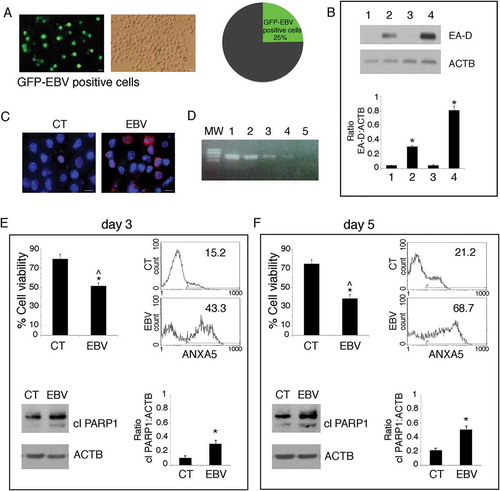 Figure 1. EBV infects differentiating monocytes and impairs cell survival. Primary monocytes (CD14+) were infected with recombinant EBV particles purified from 293/EBV-WT cells or mock-infected. After 5 days of EBV infection, (a) cells were analysed by using a fluorescence microscopy showing that about 25% of the cells were infected (GFP-positive), Bars: 10 mm. EBV-infected differentiating monocytes and mock control cells were then analysed for EBV protein expression (b) by western blot for the early lytic EA-D expression, where also B95.8 and BJAB were included as positive and negative controls (lane 1 mock monocytes, lane 2 EBV-infected monocytes, lane 3 BJAB and lane 4 B95.8) and (c) by IFA for EBV gp350/220 late lytic antigen. DAPI staining is shown in blue and gp350/220 late lytic antigen in red, Bars: 10 mm; (d) the supernatant of EBV-infected monocytes was able to infect monocytes, as indicated by DNA-PCR analysis. Lane 1 and 2 B95.8 positive controls, lane 3 and 4 monocytes infected with supernatant at day 5 and 3 respectively, lane 5 negative control. (e and f) After 3 and 5 days of culture, cell survival was evaluated by trypan blue exclusion assay in EBV and mock-infected differentiating monocytes. The histograms represent the mean plus S.D. of more than 3 experiments * P value < 0.05 ^ alpha value < 0.05; ANXA5 staining in the gate of Propidium Iodide (PI)-negative cells and PARP cleavage were also evaluated in these cells. ACTB was used as loading control. One representative experiment out of 3 is shown. The histograms represent the mean plus S.D. of the densitometric analysis of the ratio of EA-D:ACTB and cleaved PARP:ACTB of 3 different experiments. * P value < 0.05.