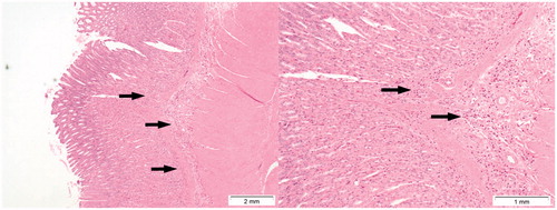 Figure 9. Presence of inflammation (arrows) in the submucosa of the stomach in a rat treated with a dose of 64 mg/kg b.w. of Cu2CO3(OH)2 NP for five consecutive days. Autopsy was at day 6, 1 day after the last Cu2CO3(OH)2 NP administration. The left image provides an overview, while the right image provides detail of inflammatory cells (arrows).
