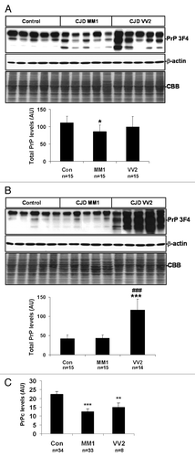 Figure 2. PrP protein expression in sCJD brain and CSF samples. (A) western blot analysis of PrP using the PrP antibody 3F4 in the frontal cortex of control, sCJD MM1 and sCJD VV2 cases represented by five cases per condition and using β-actin immunostaining and Coomassie Blue to normalize total protein loading are shown in the upper panel. Densiometric values of all the cases analyzed by western blot: control (n = 15), sCJD MM1 (n = 15), sCJD VV2 (n = 15) show significant decrease of total PrP in MM1 cases (lower panel). (B) western blot analysis of PrP using the PrP antibody 3F4 in the cerebellum of control, sCJD MM1 and sCJD VV2 cases represented by five cases per condition are shown in the upper panel. β-actin immunostaining and Coomassie-Blue were used to normalize total protein loaded into the gel. Densiometric assessment of all the cases analyzed by western blot: control (n = 15), sCJD MM1 (n = 15), sCJD VV2 (n = 14) reveals a marked increase in PrP protein expression levels in the cerebellum of VV2 (lower panel). Note the presence of the lower band of 20 kDa or 19 kDa only in sCJD cases. (C) ELISA analysis using Platelia BSE-Detection Kit (Bio-Rad Laboratories GmbH) of PrPc levels in the CSF of control (Con), sCJD MM1 and sCJD VV2. *P > 0.05; *P > 0.005; ***P > 0.001: control vs sCJD, ###P > 0.001: sCJD MM1 vs VV2. AU: arbitrary units.