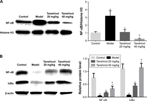 Figure 4 Effect of tanshinol on the expression of NF-κB signaling pathway.