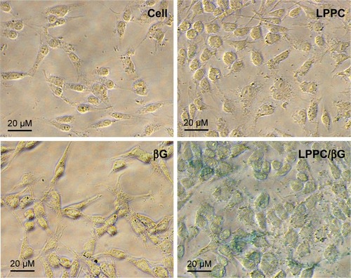 Figure 7 Enzymatic activity of delivered β-glucuronidase in vitro.Notes: HepG2 cells were treated with free βG, empty LPPC, or LPPC/βG for 4 hours. The cells were fixed and perforated by Triton X-100 for staining of βG activity with X-gluc (in blue). Representative images of three independent experiments are shown.Abbreviations: βG, β-glucuronidase; LPPC, liposomes containing polyethylenimine and polyethylene glycol complex.