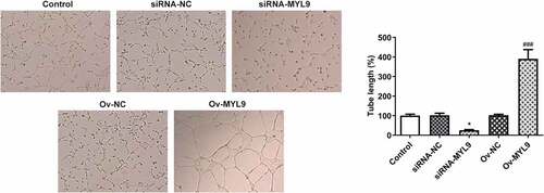 Figure 3. MYL9 affects the angiogenesis of colorectal cancer cells after overexpression or knockdown of MYL9. Tube formation assay was utilized to detect in vitro angiogenic capacity. *P < 0.05 vs. siRNA-NC; ###P < 0.001 vs. Ov-NC.