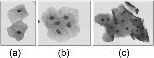 Figure 2. Overlapping or adhering cervical cell Images. Image (a) is an adhering cell clump and image (b), image (c) are overlapping cell clumps