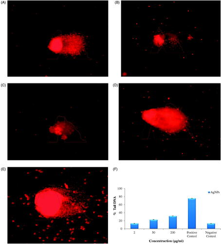 Figure 9. DNA damage in lymphocyte cells exposed to AgNPs at different concentration by alkaline comet assay(A) 2µg/ml, (B) 50µg/ml, (C) 200µg/ml, (D) Positive control (E) Negative control and (F) % tail DNA in lymphocyte cells after expose of AgNPs.