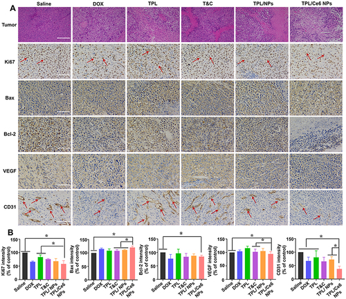 Figure 5 Immunohistochemical (IHC) staining of tumor tissues from H22-bearing tumor mice treated with various formulations. (A) H&E and IHC staining for Ki67 (the brown particles pointed by the red arrow represent positive Ki67 expression), Bax, Bcl-2, CD31 (the brown particles pointed by the red arrow represent positive CD31 expression) and VEGF (brown represents positive expression and blue represents cell nucleus). The scale bar is 50 μm. (B) Semi-quantitative analysis of Ki67, Bax, Bcl-2, VEGF, and CD31 positive expression levels was implemented by ImageJ software. *p < 0.05 indicates a statistically significant difference between the groups.