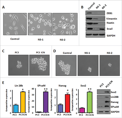 Figure 6. PC-3 ICN cells have increased the formation of prostate cancer spheres. (A) The PC-3 ICN cells with Notch-1 siRNA transfection were photographed under the microscope. CS: control siRNA; NS: Notch-1 siRNA. (B) Western blotting was conducted to measure the protein levels of CSC markers in PC-3 ICN cells after Notch-1 siRNA transfection. (C) The formation of sphere was photographed under the microscope in PC-3 ICN cells. (D) The formation of sphere was photographed in PC-3 ICN cells with Notch-1 siRNA transfection. (E) Left panel: Real-time RT-PCR was performed to detect the mRNA levels of CSC markers in prostate cancer cells. *P<0.05; **P<0.01 vs PC-3 cells. Right panel: Western blotting analysis was used to measure the protein levels of CSC markers in prostate cancer cells.