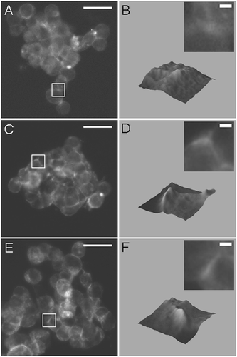 Figure 5 Fluorescence micrographs and 3-D surface intensity plots (inset shows magnified region of micrograph used for construction of surface plot) of F-actin stained with Phalloidin-Alexa488 in aggregates aged 2 min (A, B), 4 min (C, D), and 11 min (E, F), demonstrating that an increase in F-actin at regions of contact between HepG2 cells can be detected in aggregates aged 4 min. Bar in micrographs represents 20 μ m, and bar in magnified insets represents 2 μ m.
