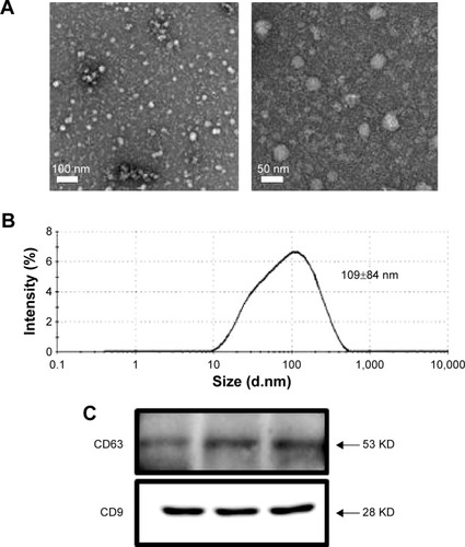 Figure 3 Properties of exosomes secreted form HEK293 cells.Notes: (A) Bio-TEM images, (B) DLS analysis, and (C) expression of molecular markers of exosomes secreted from HEK293 cells.Abbreviations: TEM, transmission electron microscopy; DLS, dynamic light scattering.