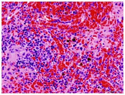 Figure 3 Histopathology of the spleen in a treated dog, showing no evidence of change compared with normal spleen. This picture also shows occasional macrophages that contain golden-brown pigment granules consistent with hemosiderin.Figure 4 Tissue concentrations of CTI 52010. Accumulation of CTI 52010 was determined post mortem in the liver, kidney, and spleen of all three dogs using highpressure liquid chromatography following tissue homogenization and extraction.Display full size
