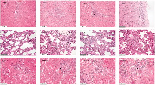 Figure 4. Organ damage and changes in the liver–renal function after associating liver partition and portal vein ligation. (A) The immunohistochemical staining for the liver in the regenerating lobes in each group. No histopathological findings were observed in group 1; inflammatory cell infiltration in the portal area and thickness of the Glisson capsule were observed in the three remaining groups (black arrow). (B) The HE staining of the lungs in each group. Inflammatory cell infiltration was observed in group 1 (black arrow); pulmonary interstitial edoema, inflammatory cell infiltration (black arrow), and the wideness of the alveolar septum (red arrow) were observed in group 2; pulmonary interstitial edoema and inflammatory cell infiltration were observed in the two remaining groups (black arrow). (C) The HIC staining of the kidneys in each group. Inflammatory cell infiltration of small arteries and para-arterioles in the renal cortex was observed in each group (black arrow). (D) Liver function. (E) Renal function. Scale bars, 50 µm. α, P < .01 for group 1 vs. group 2; β, P < .01 for group 1 vs. group 3; ɣ, P < .01 for group 1 vs. group 4; δ, P < .01 for group 2 vs. group 3; ρ, P < .01 for group 2 vs. group 4. The values are the means ± the standard deviation. Group 1 is the mock group; group 2 is the implantation without associating liver partition and portal vein ligation (ALPPS) group; group 3 is the implantation/ALPPS group; group 4 is the implantation/ALPPS/CA group.