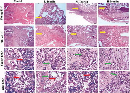 Figure 2. HE staining images of the fracture site in the rat model of fractures. Magnification ×40 and ×400. Yellow arrow: trabecular bone. Red arrow: chondrocytes. Green arrow: osteoblasts.