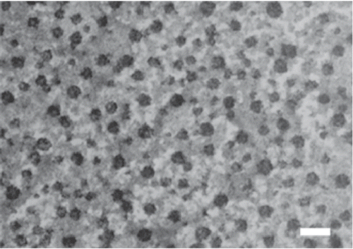 Figure 3.  Transmission electron microscopy (TEM) photograph of DNA/chi-87K nanoparticles. Particles were observed after staining with 1% phosphotungstic acid. Bar = 100 nm.