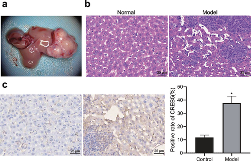 Figure 2. CREB5 overexpressed in tissues from HCC mice. A, Livers of HCC mice obtained by dissection. B, HE staining results of liver tissues from control and HCC mice (× 400). C, Positive expression of CREB5 protein in liver tissues from control and HCC mice, as determined by immunohistochemical staining (× 400). * p < 0.05 vs. the control mice. n = 10 mice in each group.