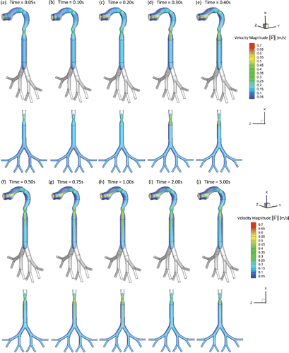 Figure 2. Transient airflow patterns in the idealized human upper airway model (Qin = 55 ml per 3.0 s): (a) t = 0.05 s; (b) t = 0.10 s; (c) t = 0.20 s; (d) t = 0.30 s; (e) t = 0.40 s; (f) t = 0.50 s; (g) t = 0.75 s; (h) t = 1.00 s; (i) t = 2.00 s; (j) t = 3.00 s.