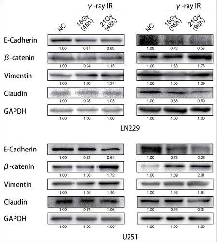 Figure 2. γ-irradiation could induce the Epithelial-to-Mesenchymal Transition. Both LN229 and U251 cells manifested the EMT proteins expression changed. β-catenin and Vimentin were upregulated, while E-cadherin and Claudin were suppressed. GAPDH was used as reference. This phenomenon was more significant at 96 hours than 48 hours. According to these changes, EMT was launched after γ-irradiation. * meant P value was less than 0.05 compared with NC group.