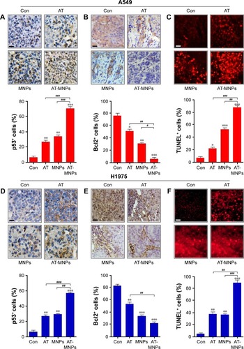Figure 10 AT-MNP therapy induced tumor cell apoptosis in tumor samples in vivo.Notes: In A549 tumors, immunohistochemical analysis was used to calculate (A) p53 and (B) Bcl2 levels; quantification of positive p53 and Bcl2 cells shown. (C) Representative images of TUNEL-positive cells after different treatments and TUNEL levels from each group. In H1975-treated tumors, (D) p53 and (E) Bcl2 levels were detected through immunohistochemical assays; quantification of positive p53 and Bcl2 cells shown. (F) Representative images of TUNEL-positive cells from each group under different conditions and TUNEL levels after various treatments. Values are expressed as means ± standard error of mean. *P<0.05, **P<0.01, and ***P<0.001 vs Con group; #P<0.05; ##P<0.01; ###P<0.001. Analysis of variance and Dunnett’s analysis were included to compare the averages of multiple groups. The scale bars are all 25 μm.Abbreviations: MNPs, magnetic nanoparticles; AT, actein; TUNEL, terminal deoxynucleotidyl transferase deoxyuridine triphosphate nick-end labeling; Con, control.