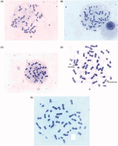Figure 10. Chromosomal aberrations at different concentrations of AgNPs: (A) 2µg/ml, (B) 50µg/ml, (C) 200µg/ml, (D) Positive control and (E) Negative control.
