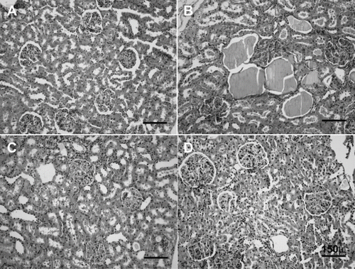 Figure 6. H&E stained of rat kidneys. A) Kidney section of sham-operated rat showing glomeruli and tubules appear normal. B) Kidney section of rat subjected to ischemia reperfusion (I/R) showing tubular cell swelling, nuclear condensation, and tubular dilatation. C) Kidney section of SMT-treated rat showing minimal tubular cell swelling, brush border loss, and nuclear condensation. D) Kidney section of MEG-treated rat showing minimal tubular cell swelling and nuclear condensation (hematoxylin and eosin; original magnification × 40).