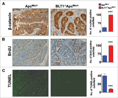 Figure 2. Analysis of β-catenin localization, proliferation and apoptosis in BLT1−/−ApcMin/+ tumors. (A) IHC analysis of β-catenin staining of colon adenomas of ApcMin/+ and BLT1−/−ApcMin/+ mice. The polyps from the BLT1−/−ApcMin/+ mice showing more intense nuclear localization of β-catenin relative to the colon polyps ApcMin/+. (B) 5-bromo-2-deoxyuridine (5-BrdU) injected into mice 2 hrs before sacrificing the mice. The cross section of colons stained with BrdU antibody. Immunohistochemical (IHC) analysis of 5-BrdU-incorporation showed a significant increase in the number of proliferating cells in colonic polyps of BLT1−/−ApcMin/+ mice. (C) Terminal deoxynucleotidyl Transferase Biotin-dUTP Nick End Labeling (TUNEL) stain performed on colons of ApcMin/+ and BLT1−/−ApcMin/+ mice. The number of TUNEL positive apoptotic cells are significantly decreased in BLT1−/−ApcMin/+ tumors compared with ApcMin/+ mice. Statistical analysis was performed using Mann-Whitney U test. Error bars, ± SEM and ***, P < 0.001.