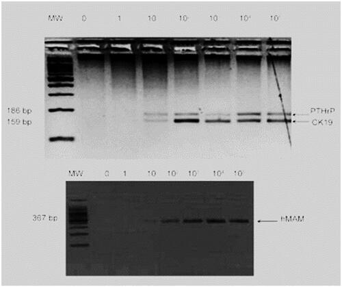 Figure 3. RT-PCR (Adapted from Skondra M et al.) [Citation25].