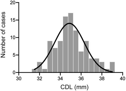 Figure 1. Histogram with a normal distribution curve (n = 105) of each CDL measured using OTOPLAN ver. 3.0. The average, maximum, and minimum CDLs were 35.1, 39.1 and 31.7 mm, respectively. CDL: cochlear duct length.