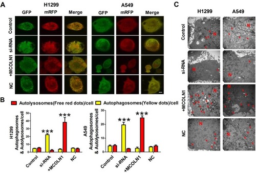 Figure 5 MCOLN1 reinforces autophagic flux. (A, B) Representative images of ﬂuorescent LC3 puncta after mRFP-GFP-LC3 adenovirus transduction (24 hrs). Mean number of autophagosomes represented by yellow puncta and autolysosomes represented by red puncta in merged images per cell. Scale bar indicates 10 μm. Results represent the mean value from 3 independent experiments, ***P<0.001. (C) Representative electronic micrograph images were shown. Scale bar indicates 500 nm. The arrows depict autolysosome, and the nucleus is denoted by N. n = 3.