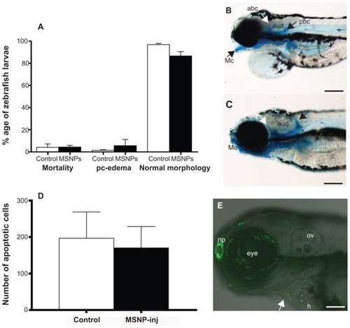 Figure 3 Toxicity of mesoporous silica nanoparticles (MSNPs). (A) Graph showing percentage mortality in zebrafish larvae, larvae affected by pericardial edema, or larvae with normal morphology. The differences between buffer-injected (control) and MSNP-injected (MSNP) embryos are not statistically significant. Bars indicate standard error of mean (n = 168 control and n = 96 for MSNP-injected embryos). The experiment was carried out two times. (B) Embryo injected at 2 days post fertilization (dpf) with MSNPs and fixed and stained at 5 dpf with Alcian blue. It had a combination of abnormalities as follows: pericardial edema, a malformed Meckel’s cartilage (Mc), anterior brachial cartilage (abc) (white arrow), posterior branchial cartilage (pbc) (black arrow), and auditory capsule (aud). Scale bar = 200 μm. (C) Embryo injected at 2 dpf with buffer only, then fixed at 5 dpf and stained with Alcian blue. This embryo shows a normal pharyngeal skeleton. Scale bar = 200 μm. Although we selected this malformed embryo from the MSNP group and the normal from the controls, there was no significant difference in the incidence of malformed embryos between buffer-injected and MSNP-injected groups (n = 25 per group). (D) Quantification of acridine orange-stained cells in control (buffer-injected) and MSNP groups. There was no significant difference after 24 hours of injection between the two groups (ten embryos per group). (E) Acridine orange-stained embryo with dead cells (green) in the eye, heart (h), and nasal placode (np). Scale bar = 100 μm.Notes: Our result shows no difference between the embryos treated with nanoparticles and controls. P < 0.1, P < 0.01; P < 0.001.Abbreviation: ov, otic vesicle.