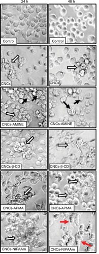 Figure 6 Microscope images of J774A.1 cells treated with unmodified and modified CNCs (50 μg/mL).