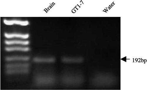 Figure 1 RT-PCR analysis of the CRF-R2 transcript present in GT1-7 cells. Expression of the expected 216-bp CRF-R2 product is present in the GT1-7 sample. Mouse brain tissue served as a positive control and water as a negative control. The experiment was repeated three times on independent samples. The amplified products were resolved in a 1% agarose gel and DNA fragments from a HpaII digest of pBluescriptII served as a molecular weight marker.