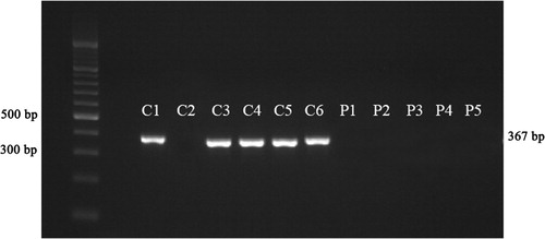 Figure 4. Quantitative expression of D5 mRNA in control (C) and drug-free patients (P1 and P2) and treated ones (P3, P4, and P5).