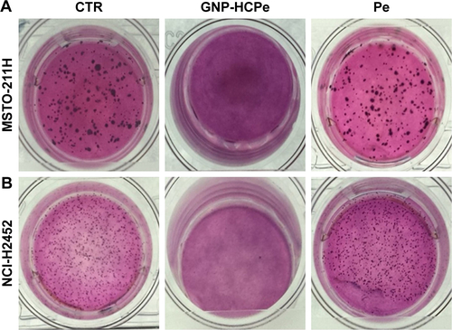 Figure S2 Effect of nanoparticles on clonogenic capacity of MPM cells.Notes: Representative images obtained by soft agar assay of MSTO-211H (A) and NCI-H2452 (B) cells treated with GNP-HCPe and Pe. After 21 days, cells were visualized by MTT test.Abbreviations: CTR, control; GNP, gold nanoparticle; GNP-HCPe, anti CD146 coated GNPs loaded with Pe; MPM, malignant pleural mesothelioma; Pe, pemetrexed.