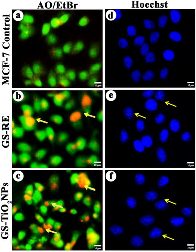 Figure 6. Fluorescence microscopy images of AO/EtBr stained individual control and nanotitania catalysts treated MCF-7 cells, (a) control (untreated) cells, (b) G. superba rhizome extract and (c) nanotitania catalysts treated cells. The arrows are denoted by green colour (live cells), orange colour (proapoptotic cells) and red colour (dead cells). Hoechst nuclear staining images of control cells (d) and arrows indicate nuclear materials in apoptotic cells (e, f). The white scale bars are 10 µm.