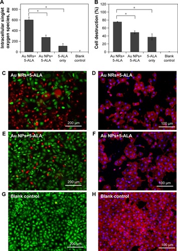 Figure 4 (A) Elevated generation of singlet oxygen in MDA-MB-231 cells upon various PDT treatments with broadband light irradiation for 1 min. (B) Cell destruction rate of MDA-MB-231 cells after various PDT treatments with broadband light irradiation for 1 min. Representative fluorescent images of MDA-MB-231 cells stained with a live/dead kit (left column, live cells stained green with calcein acetoxymethyl and dead cells stained red with ethidium homodimer-1), and sulforhodamine 101-conjugated phalloidin (right column, intracellular filamentous actin stained red and cell nuclei stained blue with DAPI) after various PDT treatments under broadband light irradiation for 1 min. (C) and (D) Au NRs+5-ALA, (E) and (F) Au NPs+5-ALA, (G) and (H) blank controls (no 5-ALA and Au nanostructures).Notes: Prior to light irradiation, cells were treated with the combination of Au NRs and 5-ALA (Au NR+5-ALA), the combination of Au NPs and 5-ALA (Au NPs+5-ALA), and 5-ALA alone without Au nanostructures in serum-free medium. The final concentration of gold and 5-ALA as maintained at 40 µM and 1 mM for each group. Cells treated with serum-free medium without Au nanostructures or 5-ALA were considered as blank control. The data are representative of three separate experiments; *p<0.01.Abbreviations: 5-ALA, 5-aminolevulinic acid; Au NP, gold nanoparticle; Au NR, gold nanoring; PDT, photodynamic therapy.