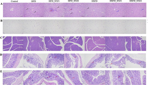 Figure 4. Hematoxylin and eosin staining of tissue in mice (original magnification, ×200). (A) Liver; (B) Epididymal fat pads; (C) Pancreas; (D) Cecum; (E) Colon. The black arrow pointer indicates fat droplets. The red arrow pointer indicates inflammatory cell infiltration. The blue arrow pointer indicates cytoplasmic loosening.