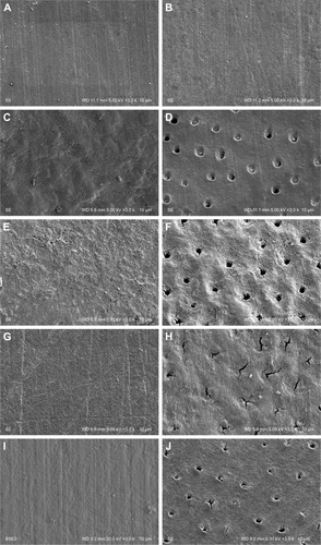 Figure 4 SEM of enamel (A, C, E, G, and I) and cementum (B, D, F, H, and J) surface BD (A and B), AD (C and D), with no treatment application (E and F), after application of NHA (G and H) and CT (I and J).Abbreviations: AD, after demineralization; BD, before demineralization; CP, Clinpro; NHA, nano-hydoxyapatite; SEM, scanning electron microscopy.
