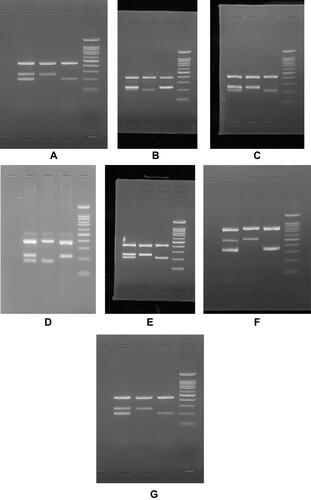 Figure 1 ARMS-PCR analysis of the (A) rs2237892 C > T, (B) rs1470579 C > A, (C) rs10946398 C > A, (D) rs8050136 A>C, (E) rs10830963 C > G, (F) rs13266634 C > T and (G) rs7903146 T > C on 1.5% agarose gel. Note: Lanes 1, 2, 3 and 4 represent fo-ro/fo-ri/fi-ro, fo-ro/fo-ri, fo-ro/fi-ro and DNA molecular marker, respectively.