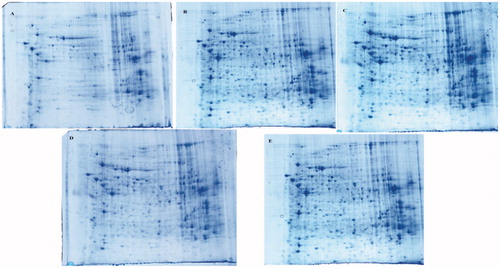 Figure 2. Differential effect of AS treatment on BD as visualized by 2D PAGE. Liver were extracted and analyzed by 2D PAGE (first dimension, 18 cm, pH 4–7, nonlinear gradient of IPG strips; second dimension, 12.5% SDS-PAGE) and visualized by silver staining. (A) control; B BD; C ASM; D ASL;E ASH;.
