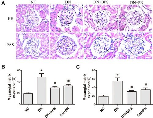 Figure 3 Effects of PN treatment on mesangial expansion in diabetic rats. Representative hematoxylin and eosin (HE) and periodic acid-schiff (PAS) staining of kidney sections (A)(magniﬁcation 400×). Semiquantitative analyses of mesangial expansion detected by HE (B) and PAS (C). PN and BPS were administered once daily by oral garage for 12 weeks. Results were expressed as the mean ± SEM (n = 7). The arrow represents mesangial expansion in diabetic rats glomerular. *P<0.05 vs NC; #P<0.05 vs DN.