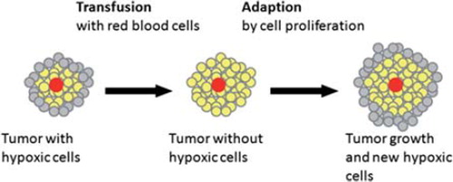 Figure 3. Tumor adaption to red cell blood transfusion by growth (adapted from Hirst et al. [Citation60]).