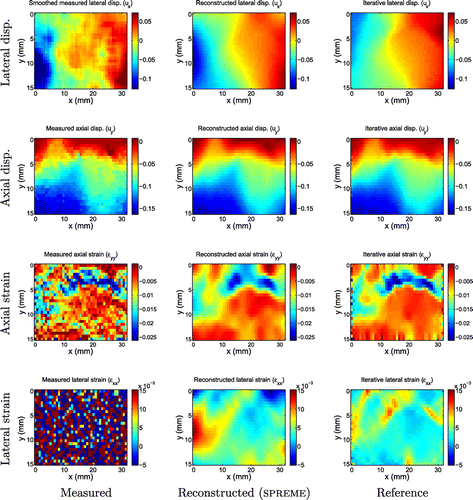 Figure 16. Displacement and strain images for invasive ductal carcinoma 2. In this example, we see more consensus between the gross features of the smoothed measurements, the reconstructed SPREME lateral displacements and the reference lateral displacements.