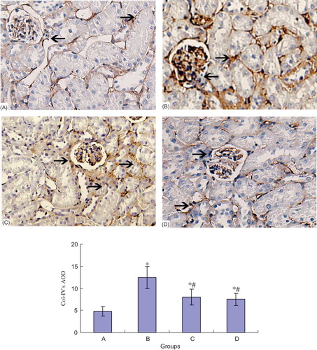 Figure 3. Collagen IV protein expression of the kidney in different groups (×100). *p < 0.05 compared with normal group, #p < 0.05 compared with DN group. (A) Control group; (B) DN group; (C) DN + NCTD (0.05 mg/kg/day) group; (D) DN + NCTD (0.1 mg/kg/day) group.