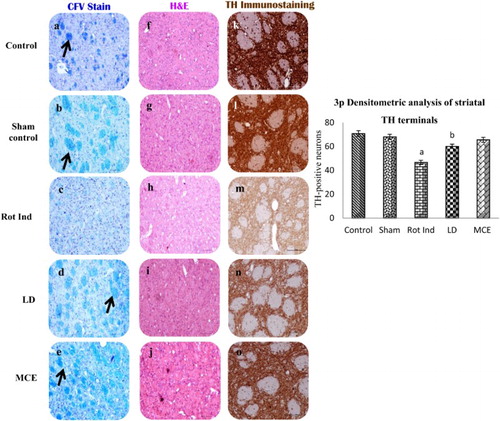 Figure 3. Histopathological analysis and immunohistochemical localization of TH-Positive neurons and striatal bundles in the striatum of rotenone-infused Parkinsonian rats treated with or without MCE/LD. Images a–e represents Kluver Barrera staining; Black arrow shows compact white matter fascicles and prominent Nissl staining which was absent in rotenone-infused PD rats. Further, rotenone-induced rats demonstrated lesser degree staining intensity. Similar findings were observed in H&E images (f–j); however, it is important to observe that there is a remarkable restoration seen in LD and MCE administered rats. In this juncture, histochemical investigation makes it convenient to understand efficacy of the MCE treatment, as the TH expression (k–o) is very meager in Group III rotenone-infused PD rats signifying the degeneration and impairment of nigrostriatal pathway (3p).