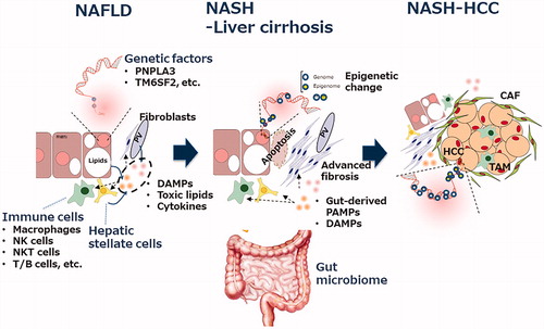 Figure 1. Multifaceted mechanisms in the progression from steatosis to fibrosis/cirrhosis/HCC in non-alcoholic fatty liver disease. The major players involved in the pathogenesis of NAFLD/NASH are shown. The details are described in the text. CAF: cancer-associated fibroblasts; DAMPs: danger-associated molecular patterns; HCC: hepatocellular carcinoma; NAFLD: non-alcoholic fatty liver disease; NASH: non-alcoholic steatohepatitis; PAMPs: pathogen-associated molecular patterns; TAM: tumor-associated macrophage.