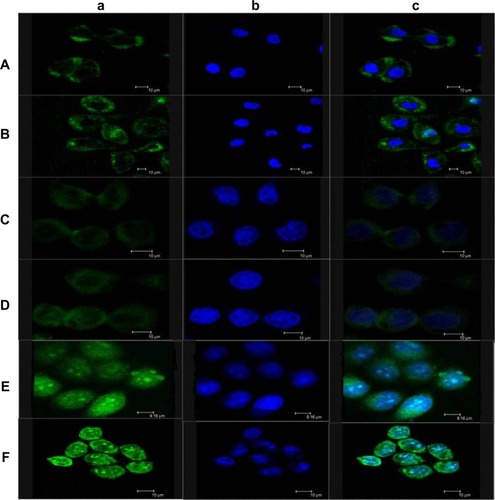Figure 12 Subcellular localization of different FITC-labeled NPs evaluated by confocal laser scanning microscopy after incubation with (A) Ost/FITC-NSC-NPs, 30 minutes; (B) Ost/FITC-LDL-NSC-NPs, 30 minutes; (C) Ost/FITC-NSC-NPs, 1 hour; (D) Ost/FITC-LDL-NSC-NPs, 1 hour; (E) Ost/FITC-NSC-NPs, 3 hours; and (F) Ost/FITC-LDL-NSC-NPs, 3 hours.Notes: FITC-labeled NPs, green (a); cell nuclei stained with Hoechst 33258, blue (b); overlay of (a) and (b) (c).Abbreviations: FITC, fluorescein isothiocyanate; LDL, low-density lipoprotein; NPs, nanoparticles; NSC, N-succinyl-chitosan; Ost, osthole.
