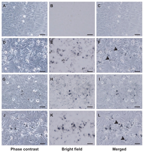 Figure 2 VGCF uptake in different types of dispersion medium. BEAS-2B cells incubated with or without 10 μg/mL of VGCF in different types of dispersion medium for 24 hours. A–C, without VGCF; D–F, with 10 μg/mL of VGCF in gelatin; G–I, with 10 μg/mL of VGCF in CMC; J–L, with 10 μg/mL of VGCF in DPPC.Notes: Arrow indicates cell with endocytosed VGCF. Bar indicates 50 μm. Phase contrast images for cell observation (A, D, G, J), bright field images for VGCF observation (B, E, H, K), and combined images (C, F, I, L) are shown.Abbreviations: CMC, carboxylmethyl cellulose; VGCF, vapor grown carbon fiber (VGCF®); DPPC, 1,2-dipalmitoyl-sn-glycero-3-phosphocholine.