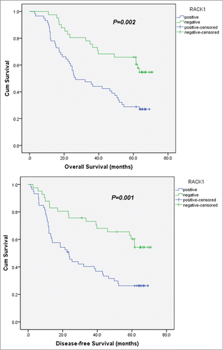 Figure 2. Kaplan-Meier survival analyses for 100 ESCC patients with or without RACK1 expression. Cox proportional hazards model was used for the analysis. Both overall and disease-free survival in patients positive for RACK1 expression were significantly shorter than those in patients who were negative (OS, P = 0.002; DFS, P = 0.001).